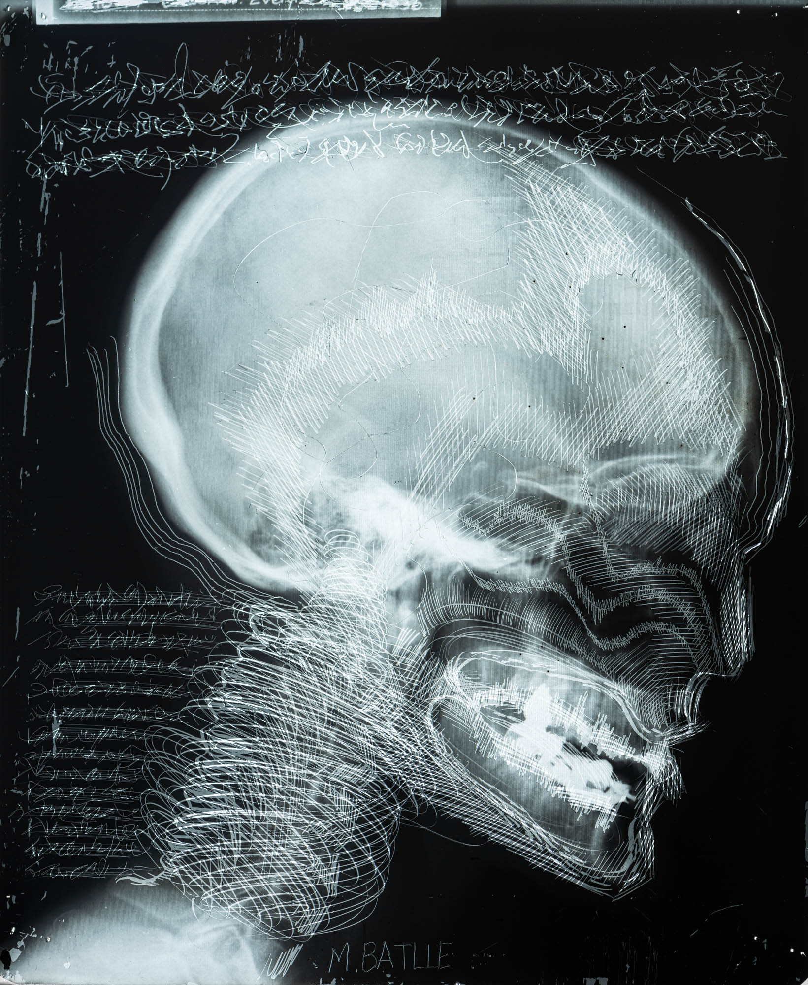 Oeuvre d'art de michel battle sur radiographie numérisée par digitize.art